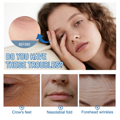 Renuvae™ Instant Face Temporary Tightener – Instant visible results in 30 seconds