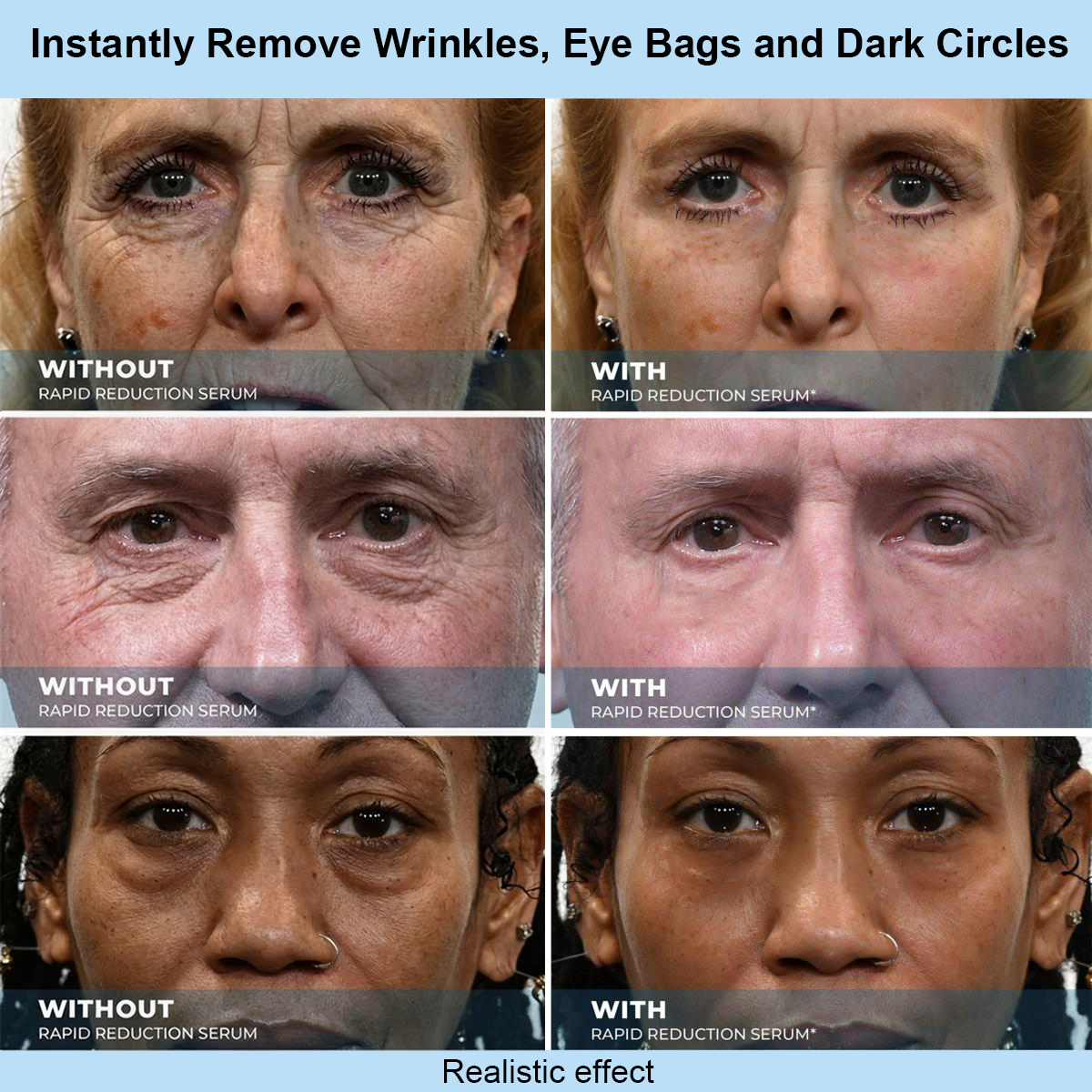 Renuvae™ Instant Face Temporary Tightener – Instant visible results in 30 seconds
