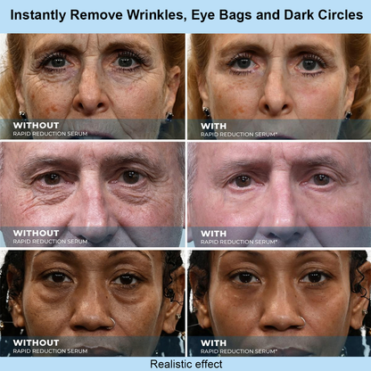 Renuvae™ Instant Face Temporary Tightener – Instant visible results in 30 seconds