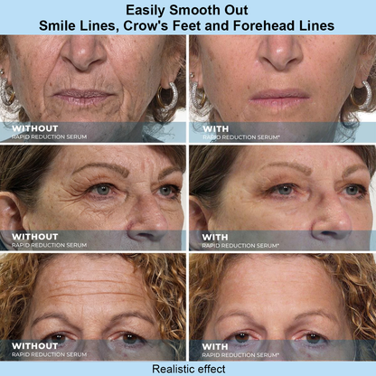Renuvae™ Instant Face Temporary Tightener – Instant visible results in 30 seconds