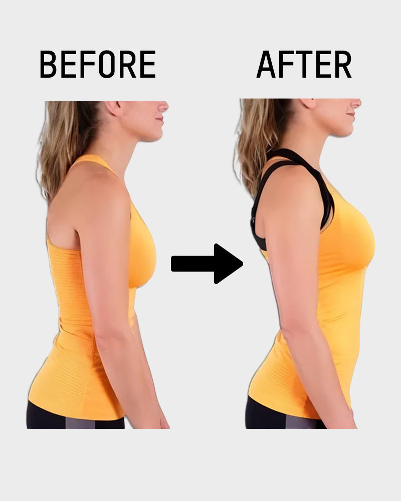 Everyday Comfort Front-Closure Cross-Back Posture Bra